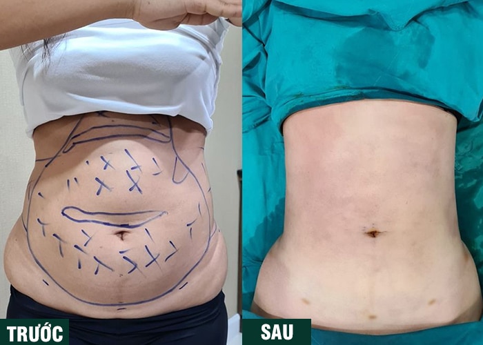 Ảnh kết quả thẩm mỹ