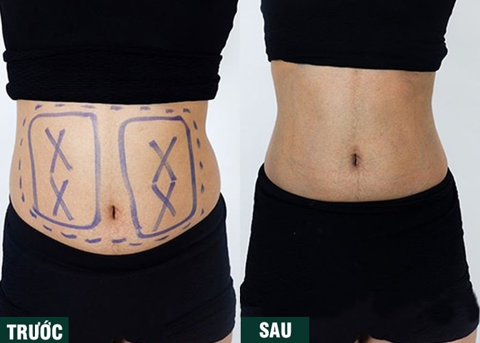 Ảnh kết quả thẩm mỹ