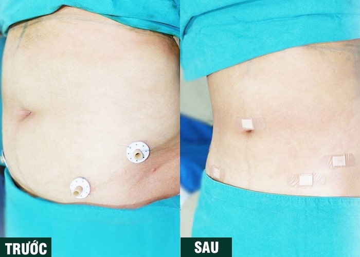 Ảnh kết quả thẩm mỹ