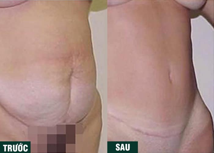 Ảnh kết quả thẩm mỹ