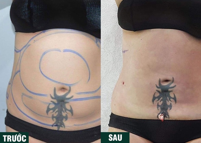 Ảnh kết quả thẩm mỹ