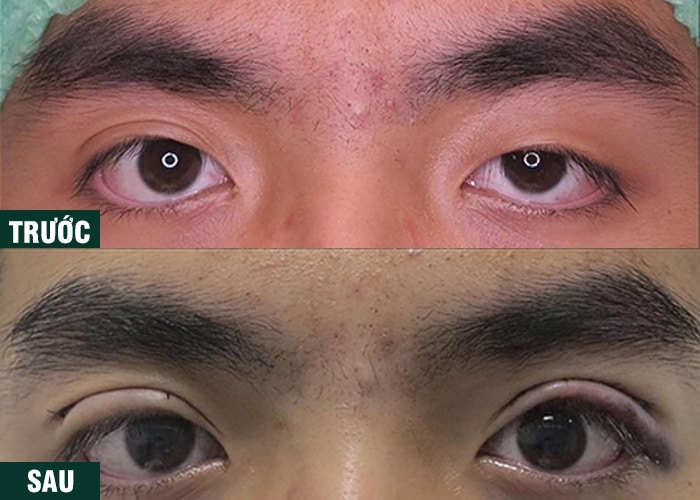 Ảnh kết quả thẩm mỹ