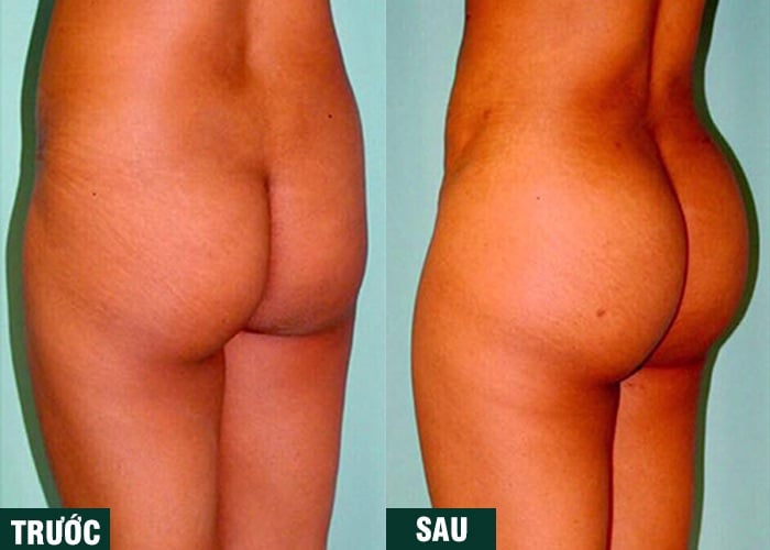 Ảnh kết quả thẩm mỹ