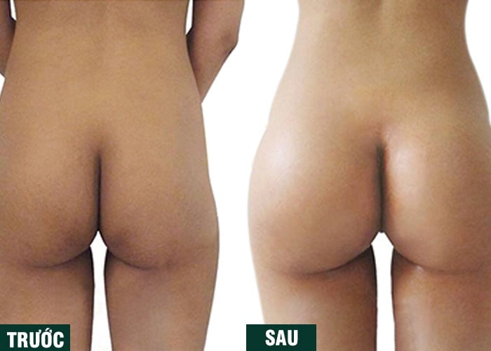 Ảnh kết quả thẩm mỹ