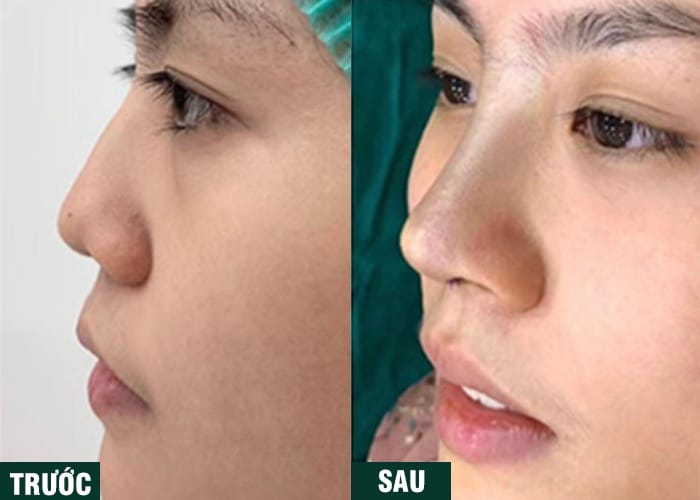 Ảnh kết quả thẩm mỹ