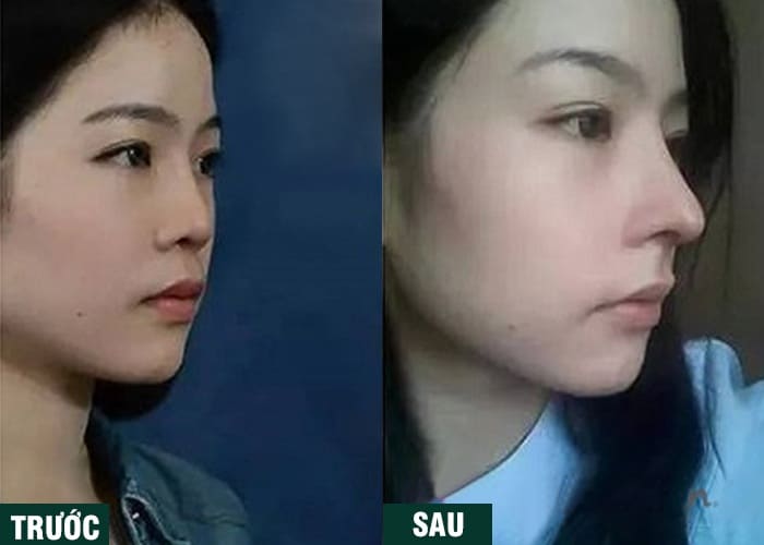 Ảnh kết quả thẩm mỹ