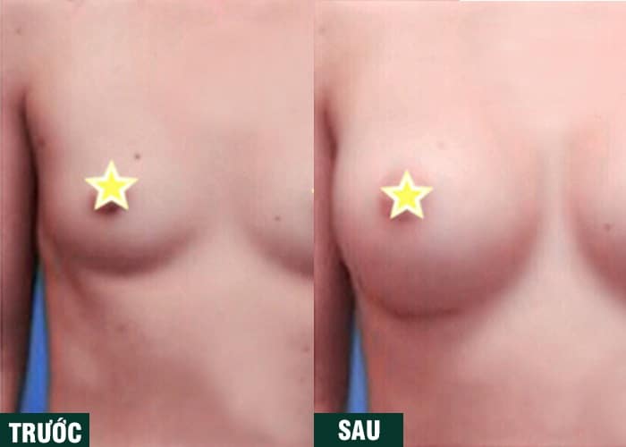 Ảnh kết quả thẩm mỹ