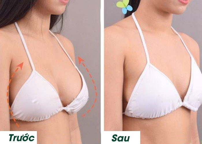 Ảnh kết quả thẩm mỹ