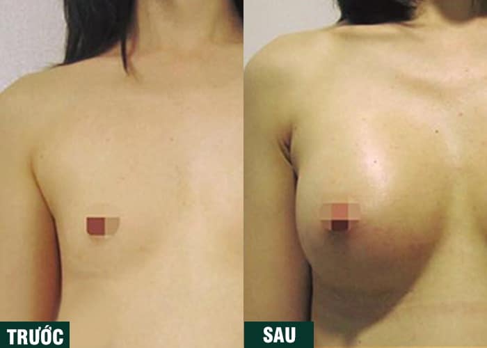 Ảnh kết quả thẩm mỹ